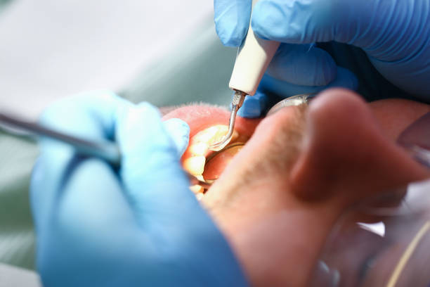 Best 24-Hour Emergency Dentist in Teaticket, MA