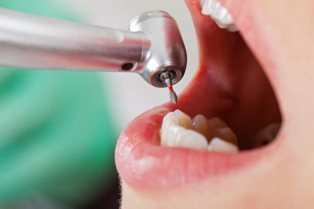Best Emergency Dentist for Knocked-Out Tooth in Teaticket, MA